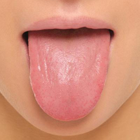 Lưỡi của bạn đang nói lên điều gì về sức khỏe?