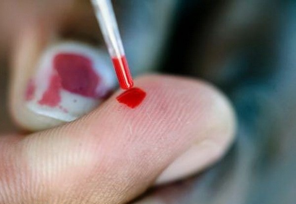 Cách sơ cứu khi bị dính máu HIV