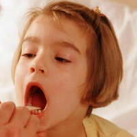 Bệnh viêm amidan quá phát ở trẻ em