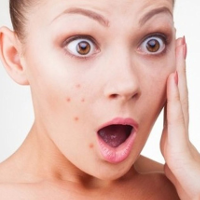 Giảm cân không đúng cách sẽ tàn phá làn da bạn thế nào?