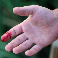 Cách cầm máu nhanh nhất khi bị đứt tay