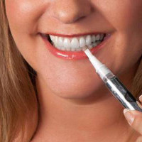Cách sử dụng bút tẩy trắng răng