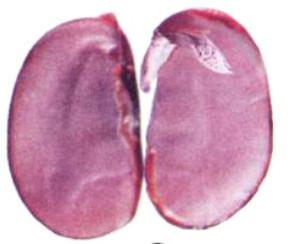 Giải bài tập SGK Khoa học lớp 5