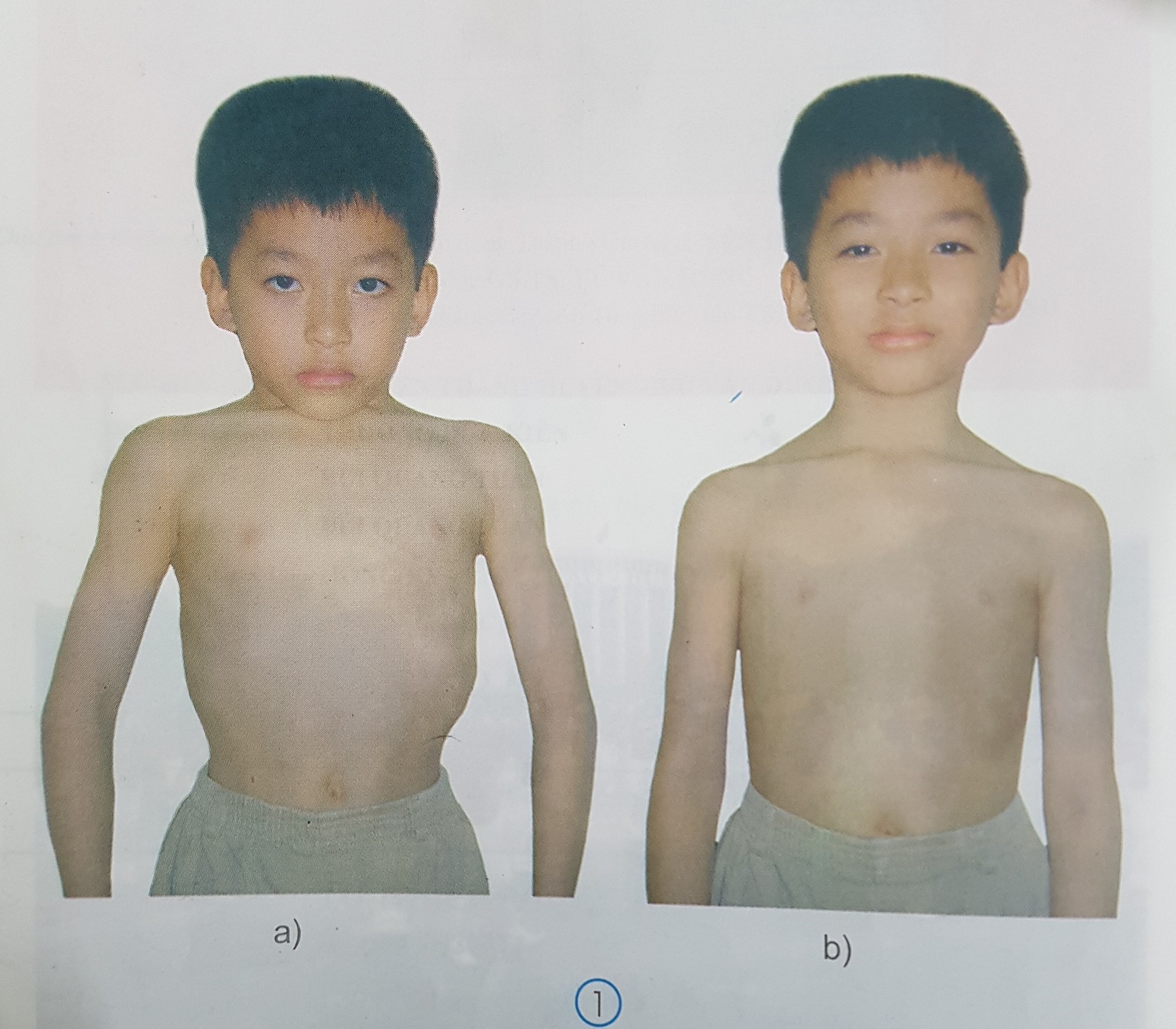 Giải bài tập SGK môn Tự nhiên xã hội 3 bài 1: Hoạt động thở và cơ quan hô hấp