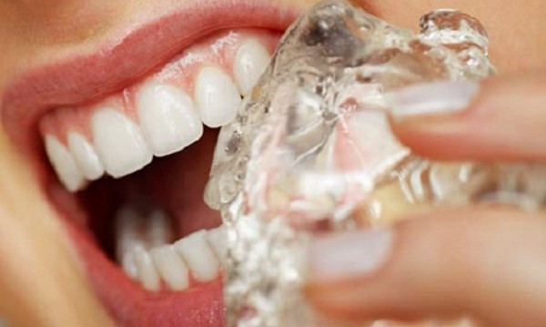 Trắc nghiệm: Những thói quen khiến răng chưa già đã rụng