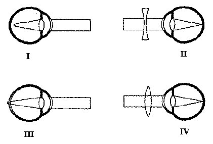 Đề kiểm tra 1 tiết môn Sinh học lớp 8 Chương IV: Thần kinh và giác quan
