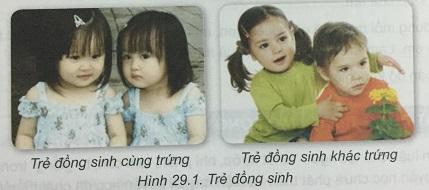 Khoa học tự nhiên 9 Bài 29: Di truyền học người