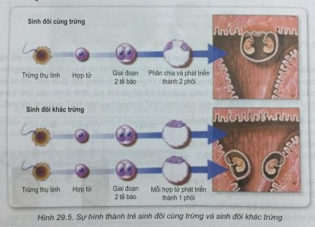 Khoa học tự nhiên 9 Bài 29: Di truyền học người