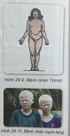 Khoa học tự nhiên 9 Bài 29: Di truyền học người