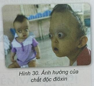 Khoa học tự nhiên 9 Bài 30: Di truyền y học tư vấn