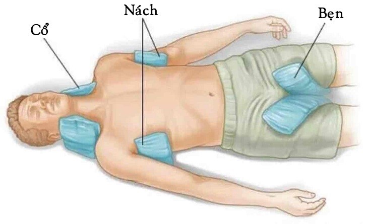 Say nắng say nóng là gì