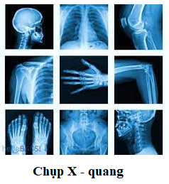 Lý thuyết Tia X | Vật lí lớp 12 (ảnh 1)