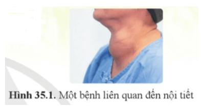 Khoa học tự nhiên 8