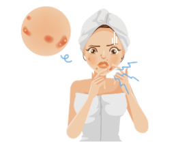 Không tự ý nặn mụn