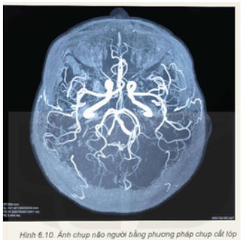 Giải Chuyên đề Vật lí 12 Kết nối tri thức bài 6