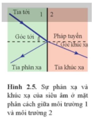 Giải Chuyên đề Vật lí 12 Cánh diều bài 2: Siêu âm và cộng hưởng từ