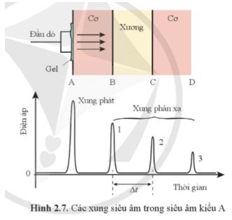 Giải Chuyên đề Vật lí 12 Cánh diều bài 2: Siêu âm và cộng hưởng từ