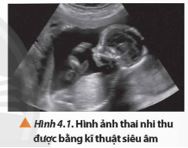 Giải Chuyên đề Vật lí 12 Chân trời sáng tạo bài 4